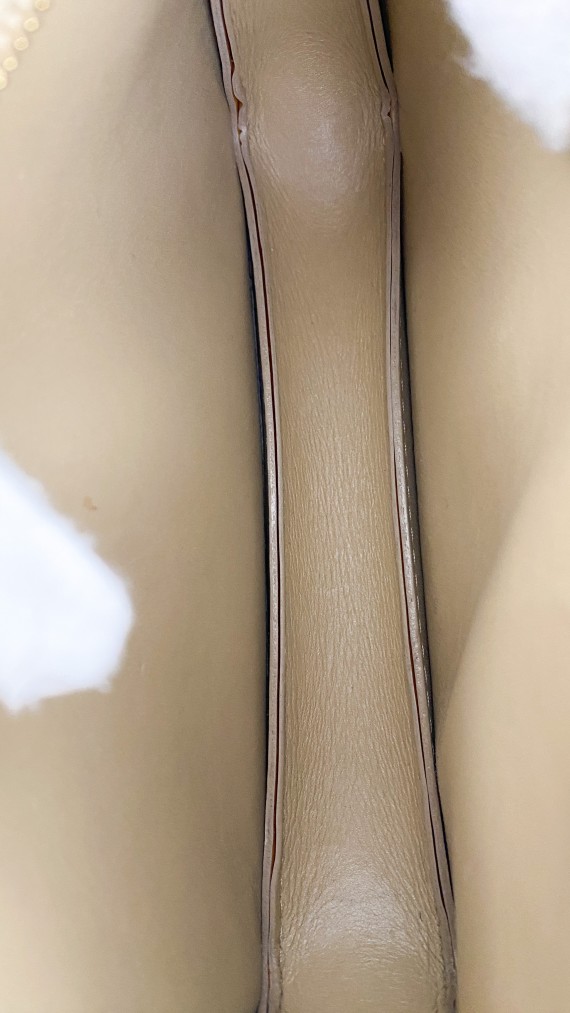 Louis Vuitton Vernis Pochette Bag
